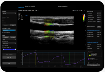 img_arterialanalysis