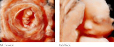 fetal-img-md