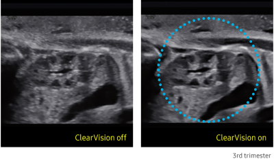 hs40_01_clearvision