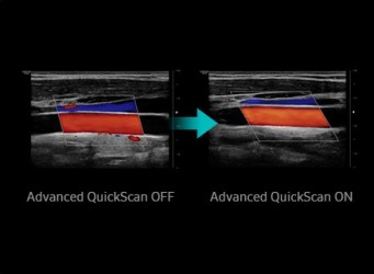 hs60_08_advanced_quickscan