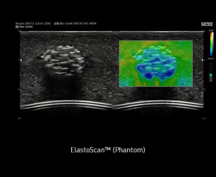 hs30_gi_03_lg_elastoscan