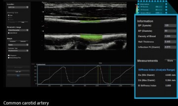 rs85_08_lg_arterial-analysis